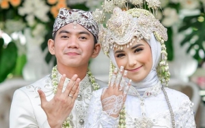 Nadya Istri Rizki DA Copot Cincin Kawin, Kedok Kemarahan Dibongkar Pakar Ekspresi