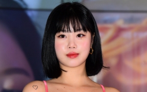 Wajah Soojin (G)I-DLE Disebut Sudah Jauh Berubah Dibandingkan Dulu, Kini Makin Dikagumi
