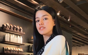 Punya Banyak Alergi, Susan Sameh Akui Kerap Lakukan Terapi