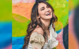Luna Maya Cerita Kronologi Kecelakaan Sepeda, Kaki Retak Hingga Tangan Dijahit