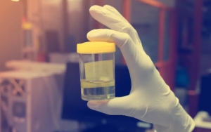 Teratur Minum Urine 7 Liter Sehari, Fisik Pria Jerman Ini Jadi Tak Pernah Sakit