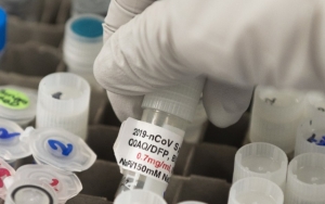 Penyakit Aneh yang Sebabkan Uji Vaksin Oxford-AstraZeneca Ditunda Terungkap