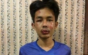 Kini Terancam Hukuman Mati, Tersangka Penusuk Syekh Ali Jaber Akui Kesal Dengar Ceramah