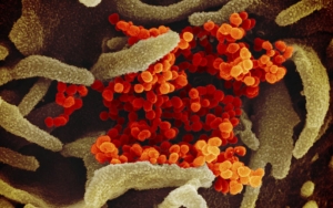 Teori Baru Ungkap Asal Usul Virus Corona Yang Masih Jadi Misteri