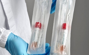 Palestina Klaim Israel Rusak Bantuan 100 Ribu Alat Tes Swab