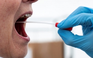 Standar Harga Swab Test Corona Akan Ditentukan, Ini Prediksi Biayanya