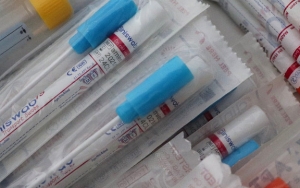 Telanjur Beli Bahan Tes Lebih dari Batas Maksimal, Begini Kata RS Soal Harga Swab Rp 900 Ribu