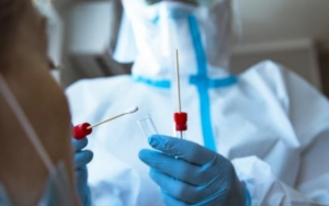 Pemerintah RI Tetapkan Harga Tes PCR Maksimal Rp 900 Ribu, Kapan Mulai Berlaku?