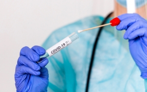 Imbas Tarif PCR Rp 900 Ribu, Lab di Aceh Setop Layani Tes Swab Karena Merugi