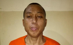 Napi Asal Tiongkok yang Kabur Ditemukan Tewas Bunuh Diri, Begini Hasil Autopsinya