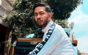 Pengakuan Onadio Leonardo Pernah Pertanyakan Orientasi Seksual Akibat Cibiran Publik Soal Gayanya