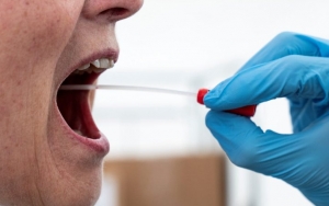 Tes Swab Maksimal Rp 900 Ribu, Masyarakat Diminta Lapor Jika Ada Faskes Pasang Tarif Lebih