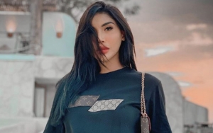 Millendaru Bikin Kecewa Karena Penampilan Terbarunya, Kembali Filler Bibir dan Ganti Gaya Rambut