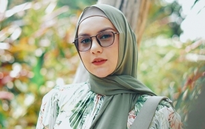 Irish Bella Putuskan Cabut Gigi Gingsul Karena Tak Pede, Begini Penampilan Terbarunya