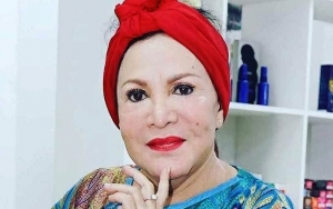 Ada Kesempatan, Mpok Atiek Akui Tolak Sembuh Dari Latah Karena Pikirkan Soal Karier