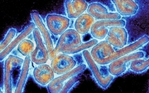 Bisa Menular Antar Manusia, Virus Chapare di Bolovia Berpotensi Jadi Pandemi Baru?