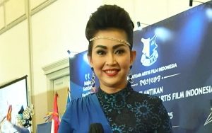 Lama Tak Ada Kabar, Ratna Listy Putuskan Operasi Hidung Karena Dirasa Kurang Proporsional