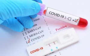 Masuk DKI Wajib Rapid Test, Bagaimana Teknis Pengecekan di Darat?