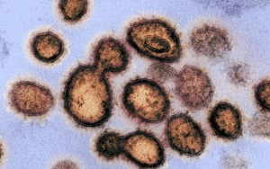 Mutasi Virus Corona Afrika Selatan Lebih Ganas, Ilmuwan Khawatir Pengaruhi Efektivitas Vaksin 