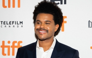 Fakta di Balik 'Wajah Baru' The Weeknd yang Disebut Hasil Oplas