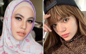 Beda dari Kartika Putri, Dinar Candy Dipuji Usai Akur Kolabs Bareng dr Richard