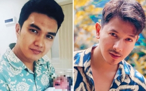 Aldi Taher Ngegas Sampai Tuding Sonny Septian Niat Pansos Karena Hal Sepele Ini