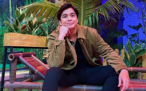 Billy Syahputra Buka Suara Soal Hubungannya dengan Amanda Manopo