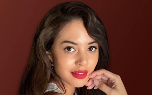 Biasa Cantik Rambut Panjang, Aurelie Moeremans Mendadak 'Botak' Mirip Deddy Corbuzier Bikin Geger
