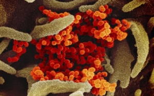 Laporan WHO Bocor, Asal-Usul Virus Corona Akhirnya Terungkap?
