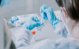 Inggris Direkomendasikan Tak Beri Vaksin AstraZeneca ke Orang di Bawah 30 Tahun