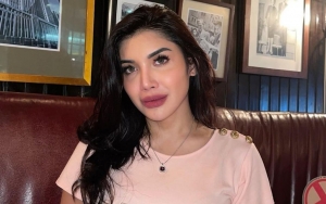 Millendaru Kena Tegur Usai Unggah Foto Seksi Pamer Paha, Diingatkan Soal Bulan Puasa