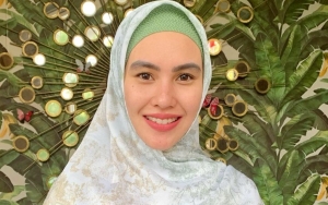 Kartika Putri Pamer Hasil Laser Hilangkan Sulam Alis: Biar Tidak Jadi Bahan Ghibah