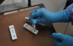 Polisi Tetapkan 5 Tersangka dalam Kasus Tes Antigen Bekas, Salah Satunya Manajer Kimia Farma