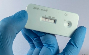 Praktik Rapid Test Bekas Mulai Sejak 2020, Tersangka Akui Utamakan Pakai Alat Daur Ulang