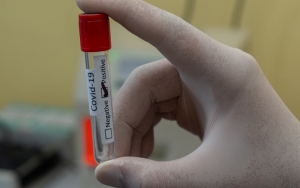 Dokter Anti Vaksin Asal Kenya Meninggal Dunia Karena COVID-19