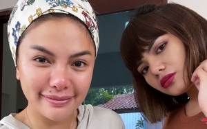 Berseberangan Dengan Nikita Mirzani, Dinar Candy Minta Maaf Lebih Pilih dr. Richard Lee