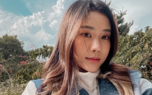 Jessica Jane Pede Pamer Wajah Berjerawat, Tetap Dapat Pujian Cantik?