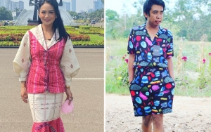 Terungkap, Begini Respon KD Saat Fotonya Dibandingkan Dengan Mimi Peri Soal Suntik DNA Ikan Salmon