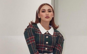 Diduga Dulunya Burik, Foto Jadul Ayu Ting Ting Saat Remaja Justru Banjir Pujian