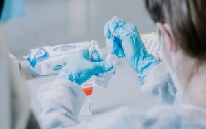 BPOM Pastikan Keamanan Vaksin AstraZeneca Batch CTMAV547, Kemenkes Minta Masyarakat Tak Perlu Takut