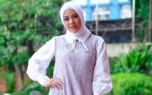 Beredar Foto Jadul Aurel Hermansyah Bikin Heboh, Bagian Dagu dan Hidung Auto Jadi Sorotan