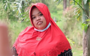 Pernah Ngaku Enggan Ubah Fisik, Kekeyi Ungkap Alasan Mau Filler Hidung