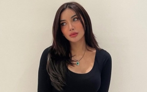 Millendaru Tampil Cantik Pamer Warna Rambut Baru, Bagian Wajah Ini Malah Ramai Bikin Salfok