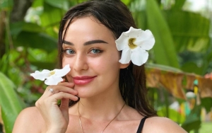 Nora Alexandra Pamer Foto Lawas Sebelum Oplas Payudara, Panen Pujian Bukti Cantik Alami