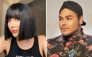 Lucinta Luna Blak-blakan Soal Oplas ke Ivan Gunawan, Ungkap Bagian Ini Butuh Biaya Paling Mahal