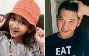 Jadi Selebgram, Foto Wajah Kekey Plek Ketiplek Rezky Aditya Saat 'Endorse' Bikin Terenyuh