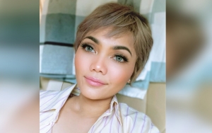 Rina Nose Bagikan Sederet Foto Transformasi Dirinya, Masa SMA Disebut Paling Original