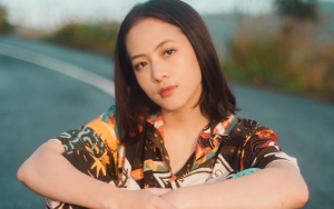 Kembali Aktif Main Instagram, Luka Lebam di Tangan Adhisty Zara Jadi Bahan Gosip