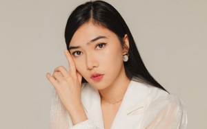 Terungkap Penyebab Isyana Sarasvati Cedera Hingga Tangan Diperban, Kondisi Belum Membaik?