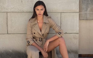 Irina Shayk Bantah Tudingan Operasi Plastik, Tegas Bilang Begini